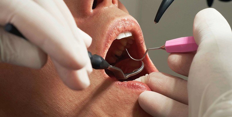 non-surgical periodontal treatment